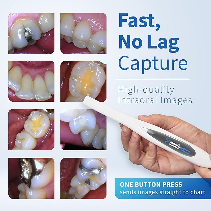 MouthWatch Intraoral Camera, Crystal Clear Images